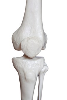 Arthroscopic Knee Synovectomy by OrangeCountySurgeons